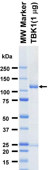 The purity was assessed by SDS-PAGE/CBB staining.